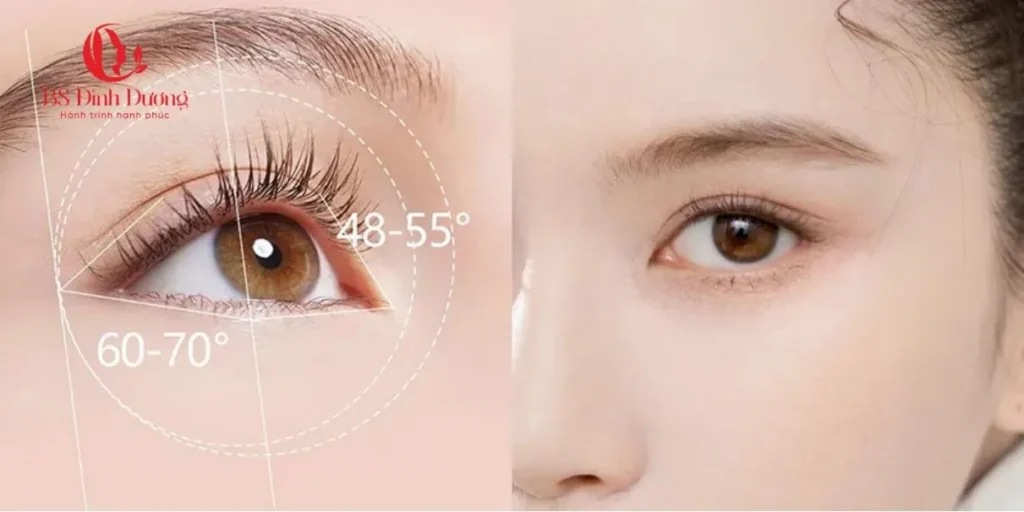 Mở góc mắt là gì? Công dụng của phương pháp này
