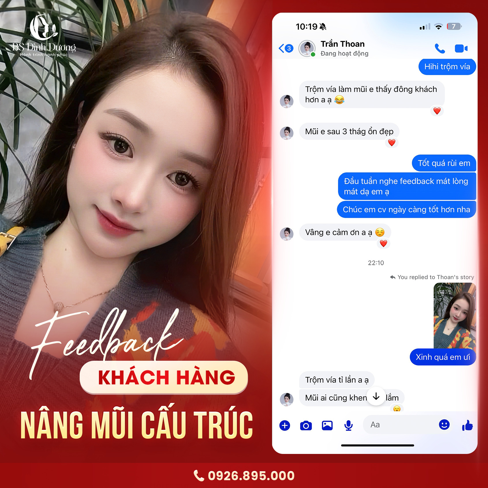 feedback-khách-hàng-nâng-mũi-cấu-trúc-bác-sĩ-đình-dương