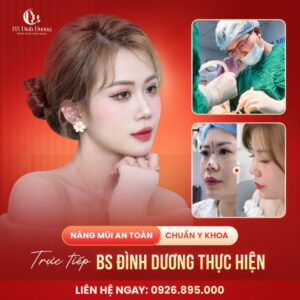 Nâng mũi cấu trúc