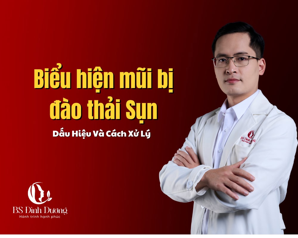 Biểu hiện mũi bị đào thải sụn sau khi nâng: Dấu hiệu và cách xử lý 2026