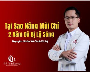 Tại Sao Nâng Mũi Chỉ Sau 2 Năm Đã Bị Lộ Sóng