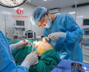 Sửa Mũi Lỗi Hếch Do Co Rút Bao Xơ Nặng