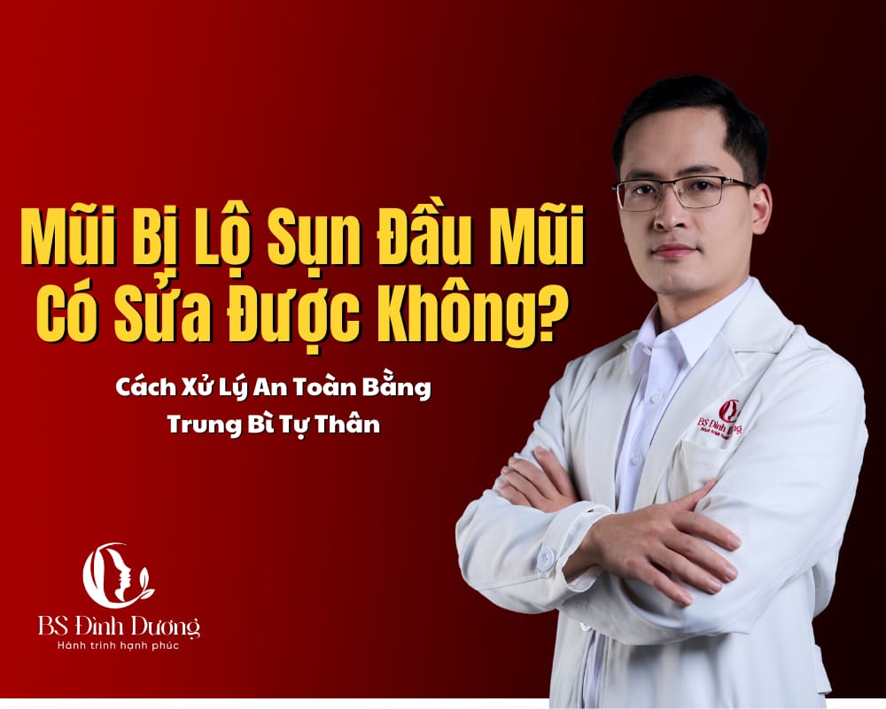 Mũi Bị Lộ Sụn Đầu Mũi Có Sửa Được Không
